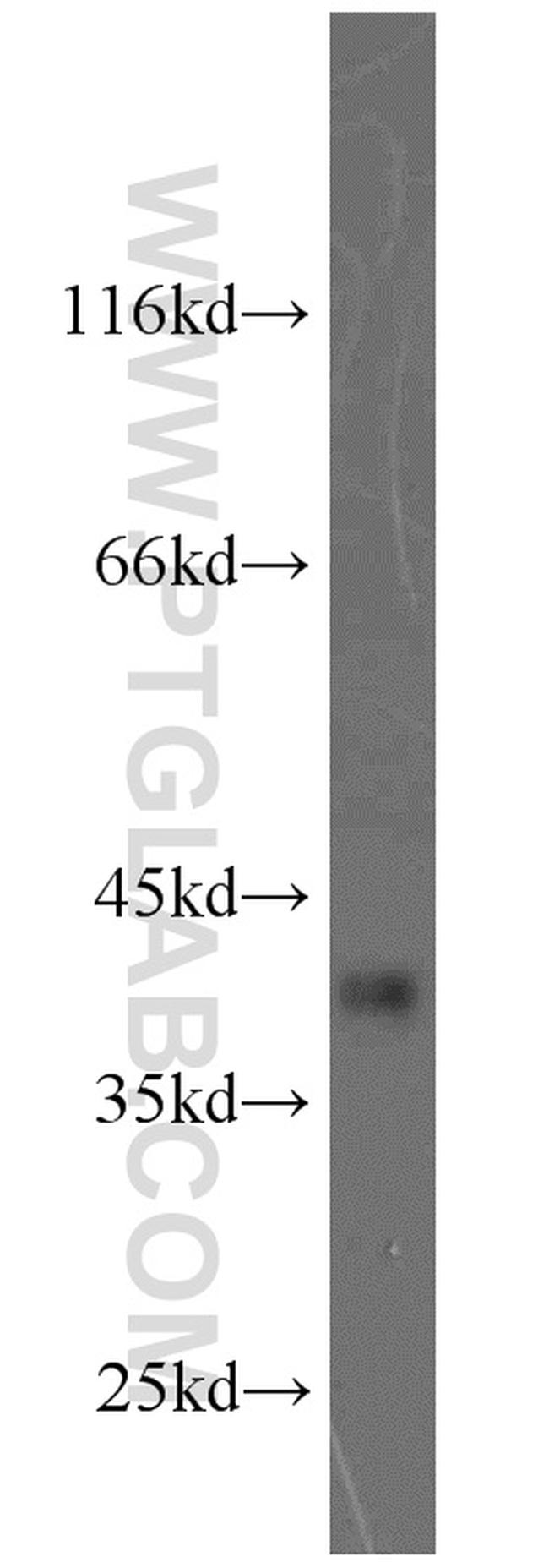 PBK Antibody in Western Blot (WB)