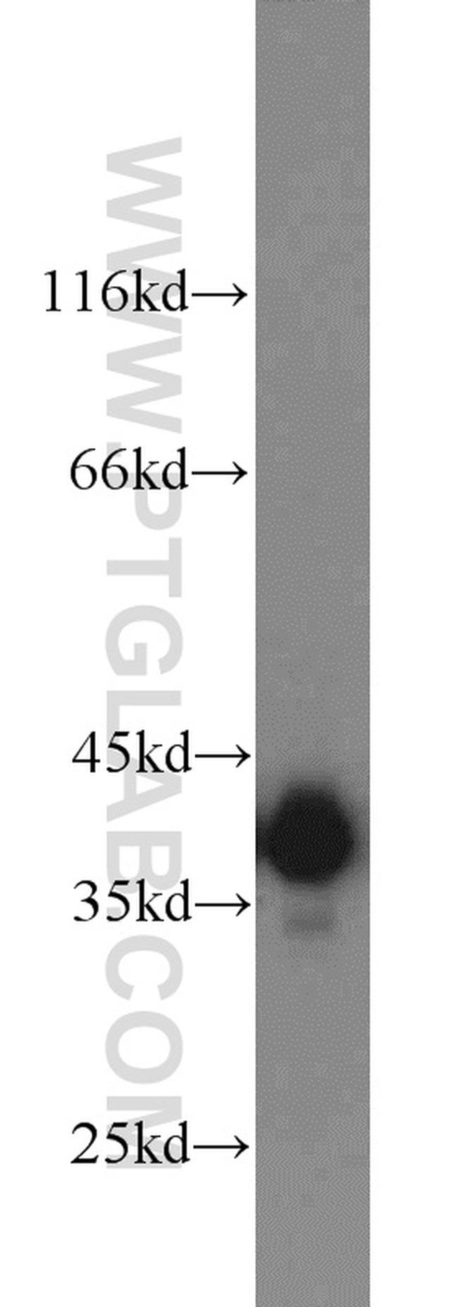 PBK Antibody in Western Blot (WB)