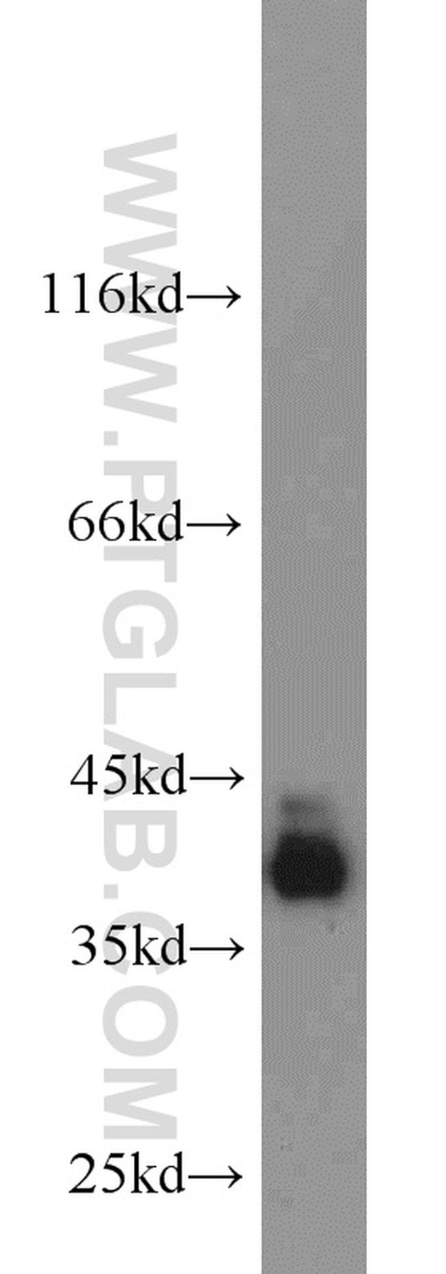 PBK Antibody in Western Blot (WB)