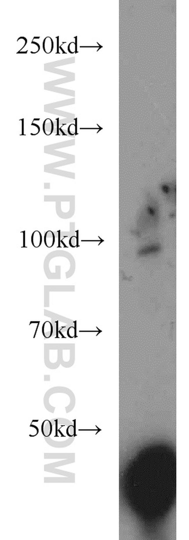 COPG2 Antibody in Western Blot (WB)