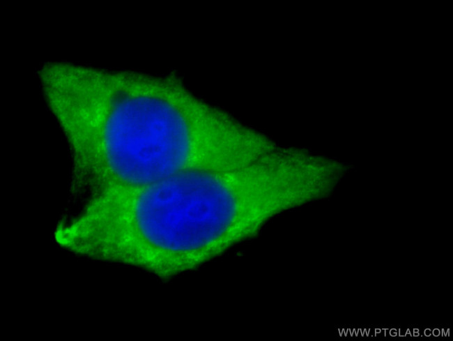 LPCAT1 Antibody in Immunocytochemistry (ICC/IF)