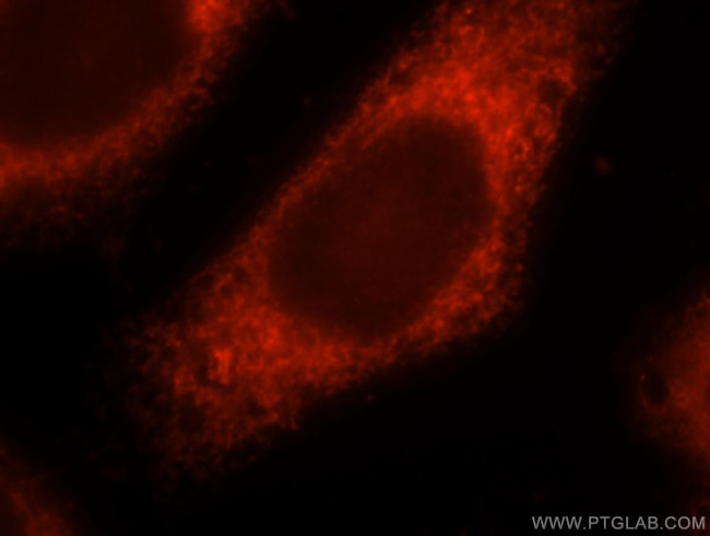 LPCAT1 Antibody in Immunocytochemistry (ICC/IF)