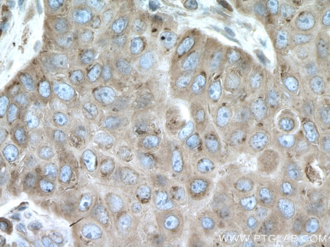 LPCAT1 Antibody in Immunohistochemistry (Paraffin) (IHC (P))