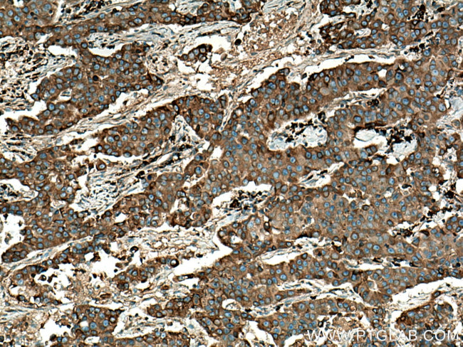 LPCAT1 Antibody in Immunohistochemistry (Paraffin) (IHC (P))