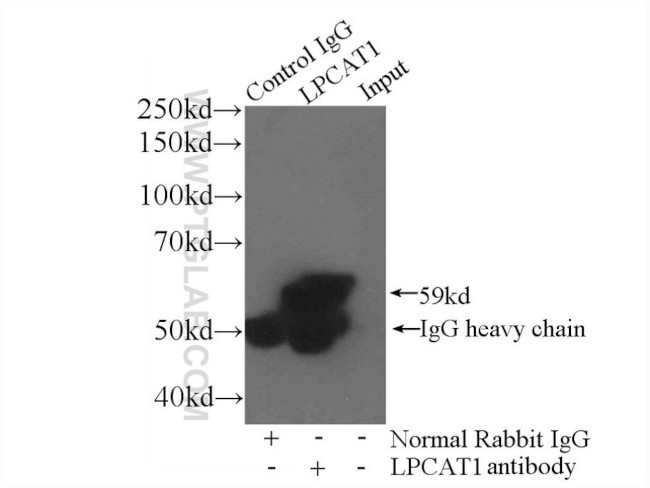 LPCAT1 Antibody in Immunoprecipitation (IP)