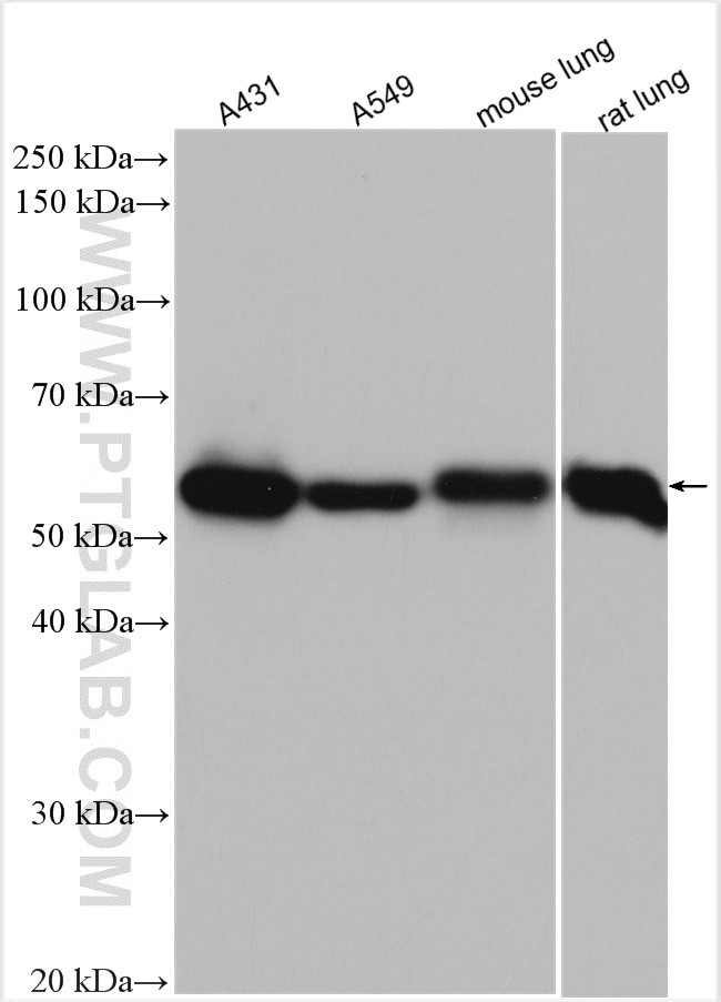 LPCAT1 Antibody in Western Blot (WB)