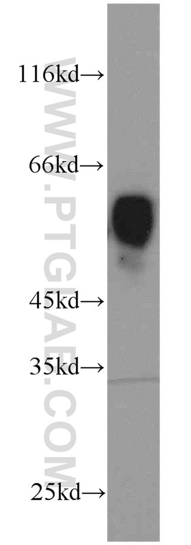 LPCAT1 Antibody in Western Blot (WB)