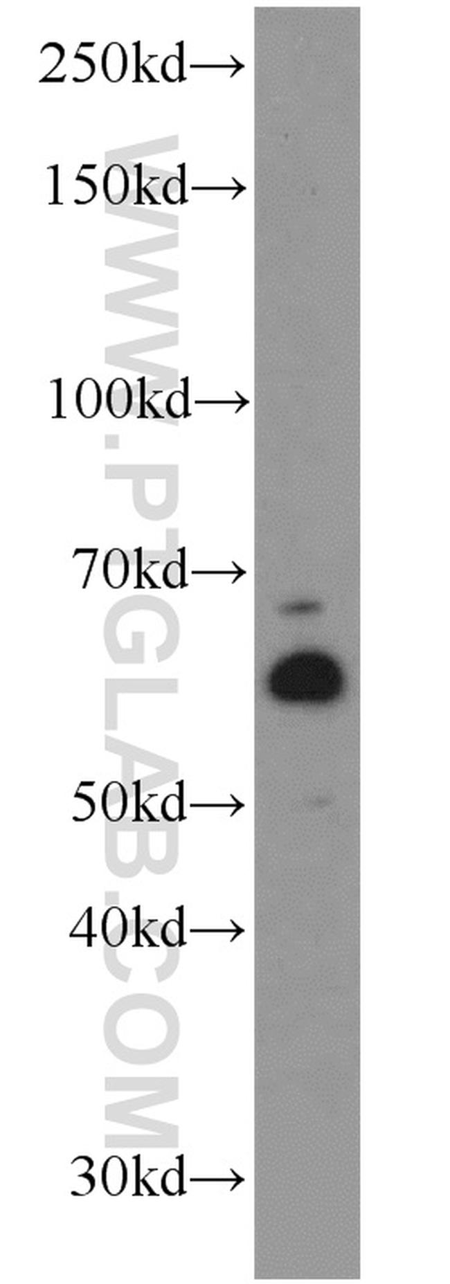 LPCAT1 Antibody in Western Blot (WB)