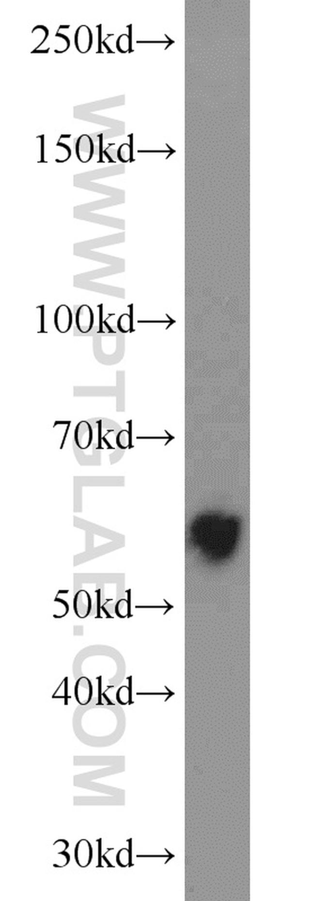 LPCAT1 Antibody in Western Blot (WB)