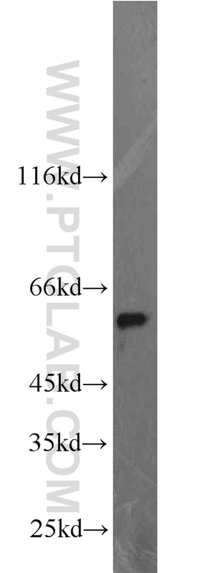 LPCAT1 Antibody in Western Blot (WB)