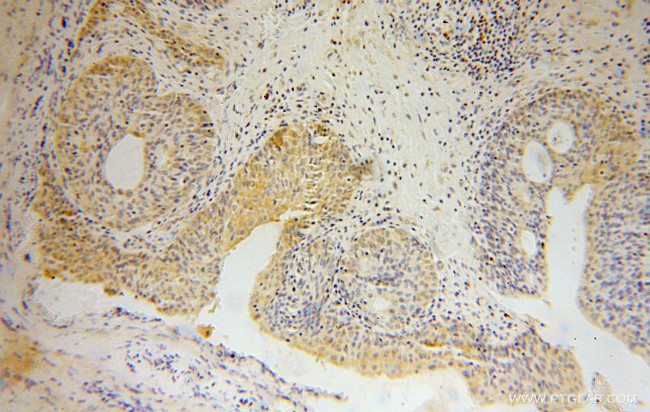 MTHFD1L Antibody in Immunohistochemistry (Paraffin) (IHC (P))