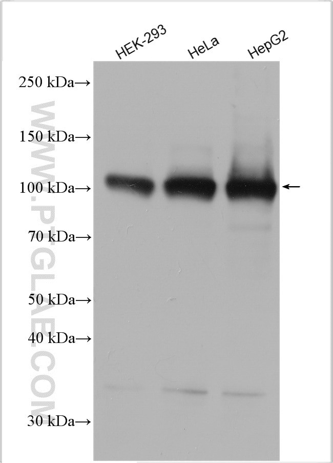 MTHFD1L Antibody in Western Blot (WB)