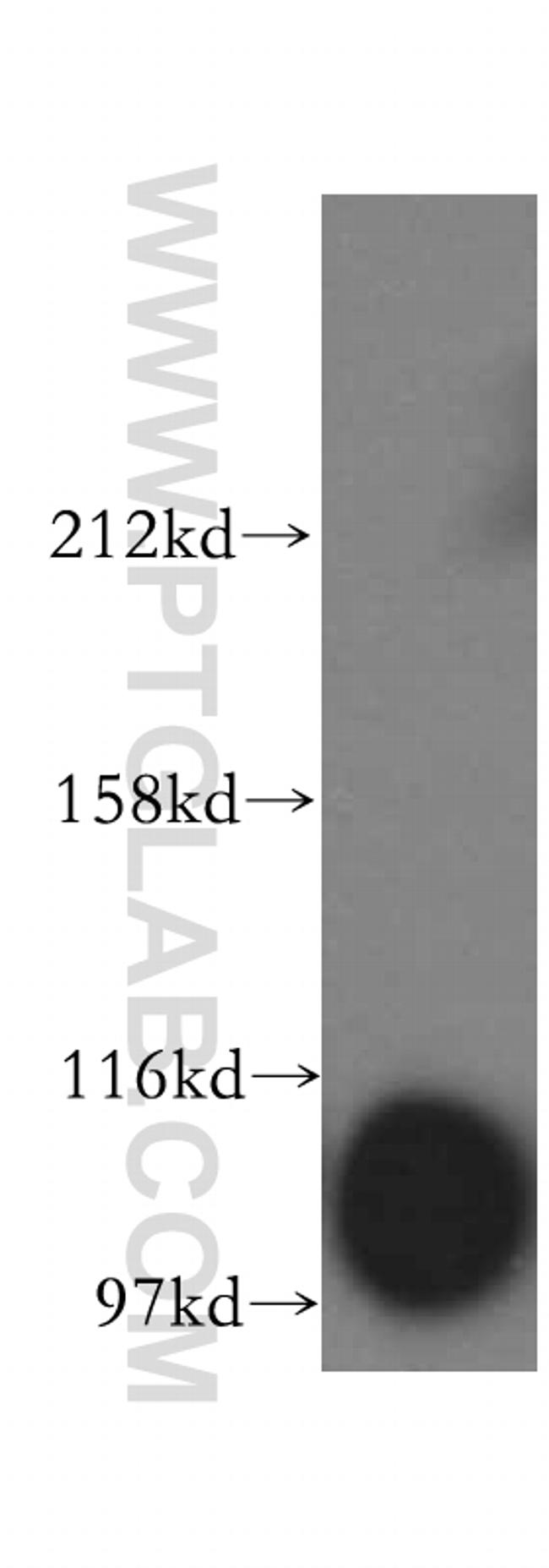 MTHFD1L Antibody in Western Blot (WB)