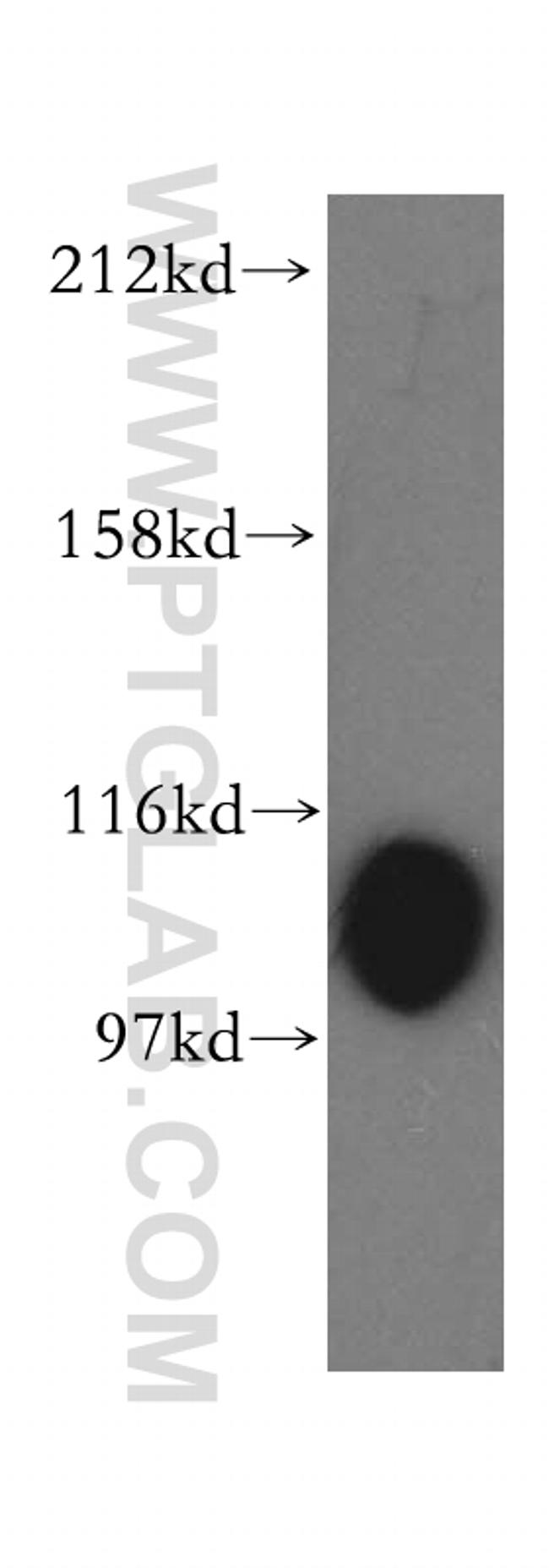 MTHFD1L Antibody in Western Blot (WB)