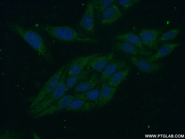 PPP1R8 Antibody in Immunocytochemistry (ICC/IF)