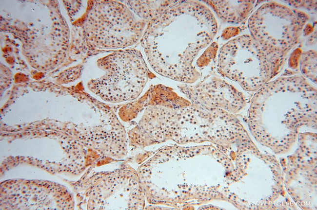 PPP1R8 Antibody in Immunohistochemistry (Paraffin) (IHC (P))