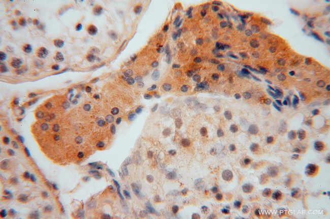 PPP1R8 Antibody in Immunohistochemistry (Paraffin) (IHC (P))