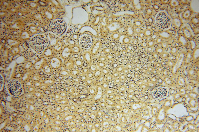 PPP1R8 Antibody in Immunohistochemistry (Paraffin) (IHC (P))