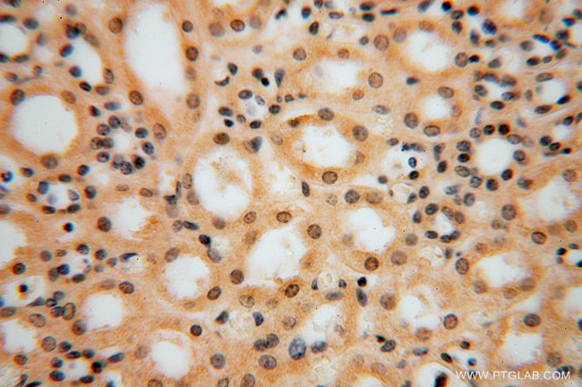 PPP1R8 Antibody in Immunohistochemistry (Paraffin) (IHC (P))