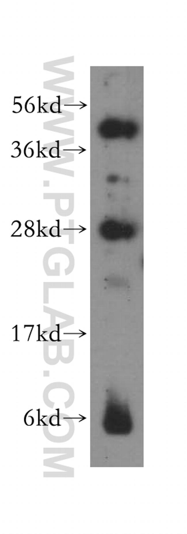 PPP1R8 Antibody in Western Blot (WB)