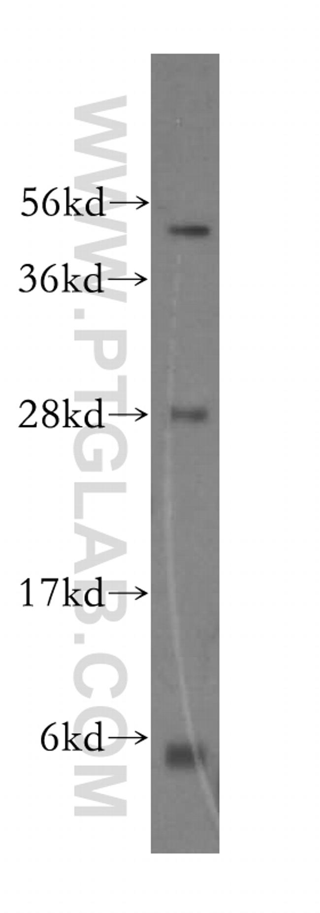 PPP1R8 Antibody in Western Blot (WB)