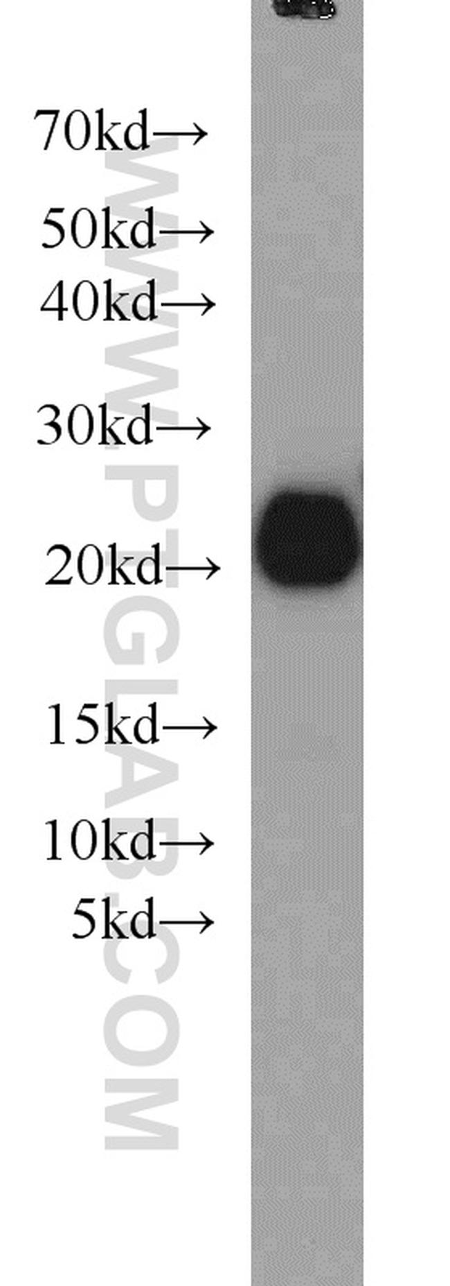 RAC1/2/3 Antibody in Western Blot (WB)