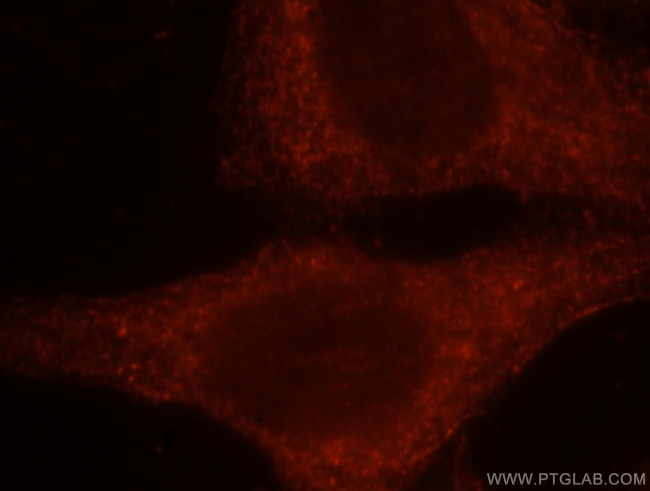 RAC1/2/3 Antibody in Immunocytochemistry (ICC/IF)