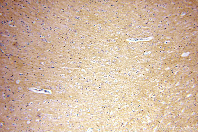 RAC1/2/3 Antibody in Immunohistochemistry (Paraffin) (IHC (P))