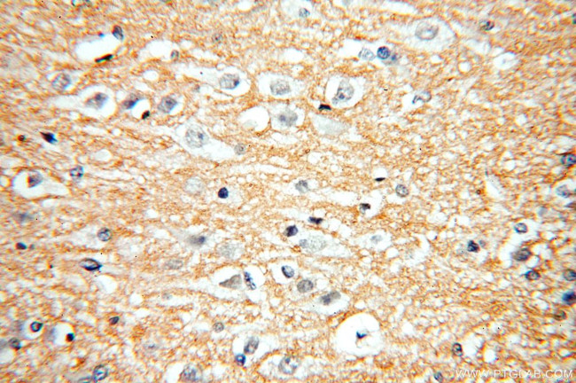 RAC1/2/3 Antibody in Immunohistochemistry (Paraffin) (IHC (P))