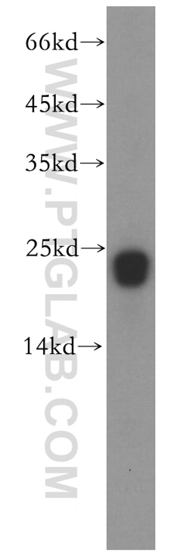 RAC1/2/3 Antibody in Western Blot (WB)