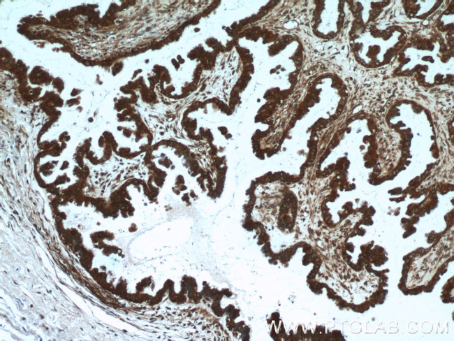 EIF4A2 Antibody in Immunohistochemistry (Paraffin) (IHC (P))