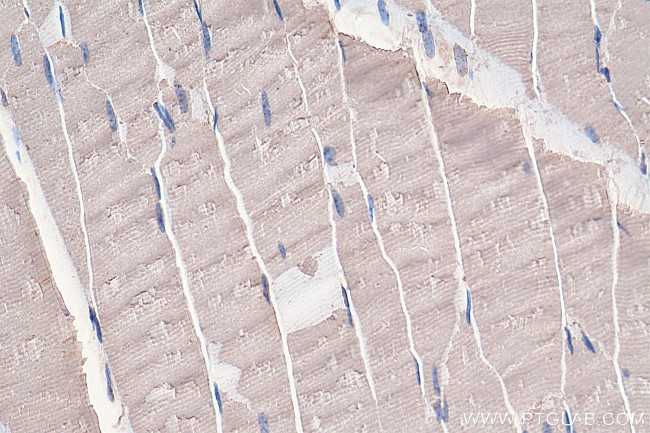 EIF4A2 Antibody in Immunohistochemistry (Paraffin) (IHC (P))