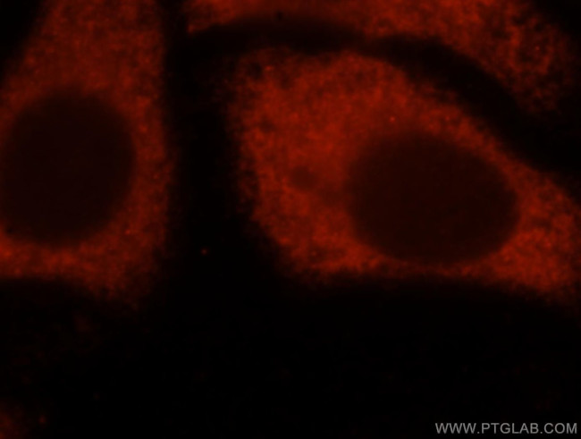 EIF4A2 Antibody in Immunocytochemistry (ICC/IF)