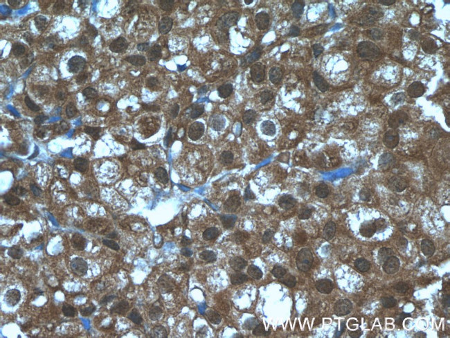 EIF4A2 Antibody in Immunohistochemistry (Paraffin) (IHC (P))