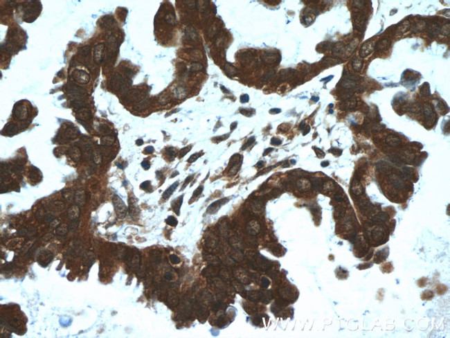 EIF4A2 Antibody in Immunohistochemistry (Paraffin) (IHC (P))