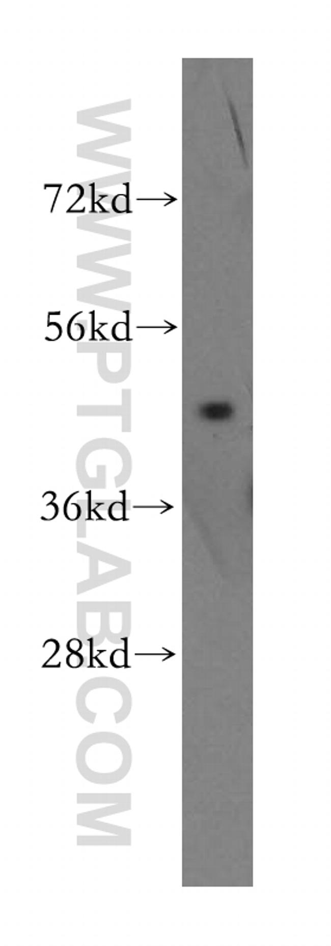 EIF4A2 Antibody in Western Blot (WB)