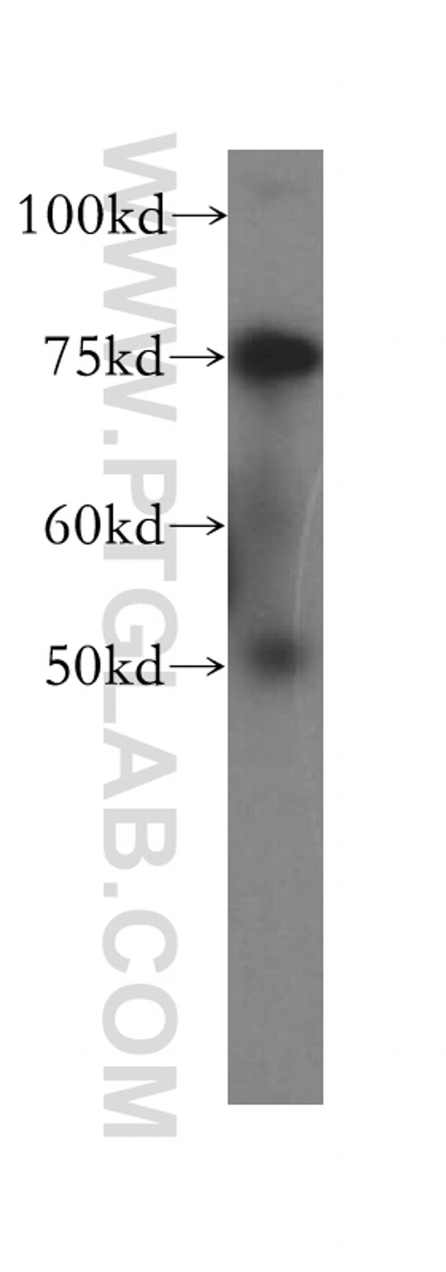 RLIM Antibody in Western Blot (WB)