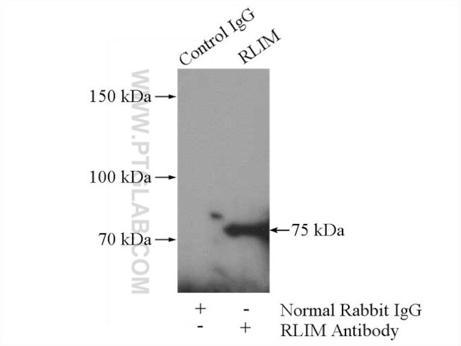 RLIM Antibody in Immunoprecipitation (IP)