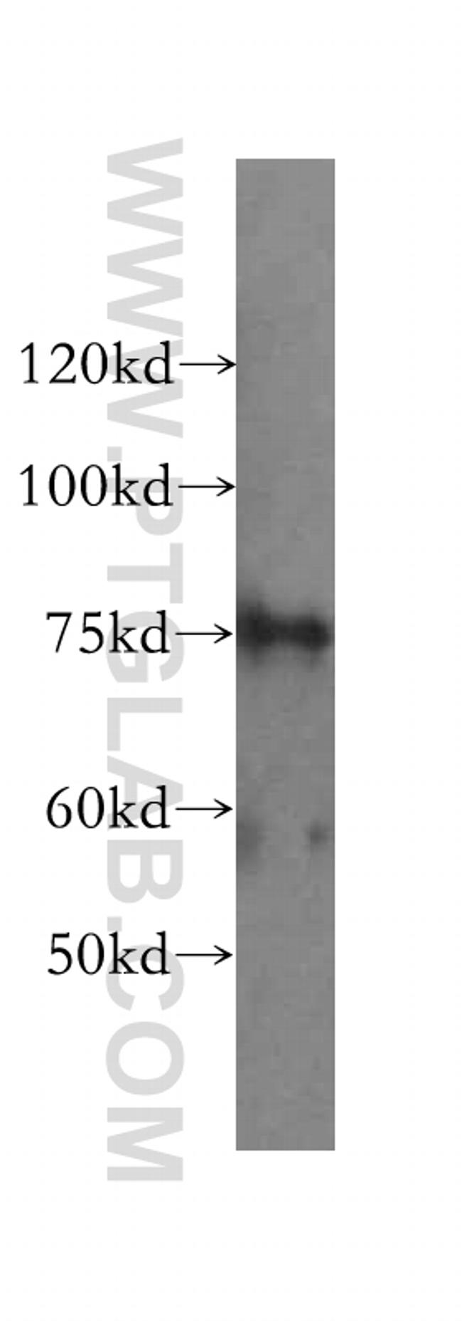 RLIM Antibody in Western Blot (WB)