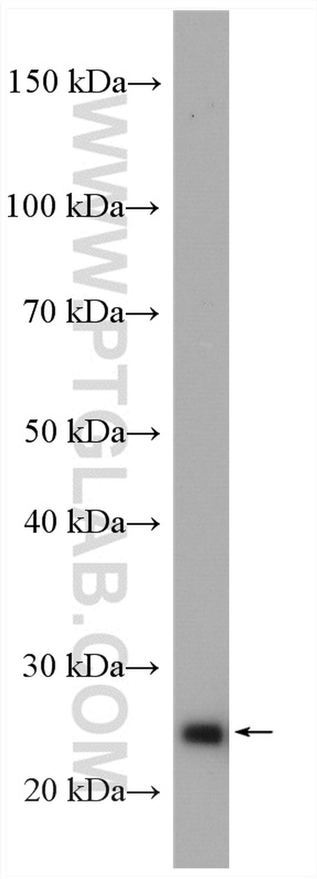 ARHGDIB Antibody in Western Blot (WB)