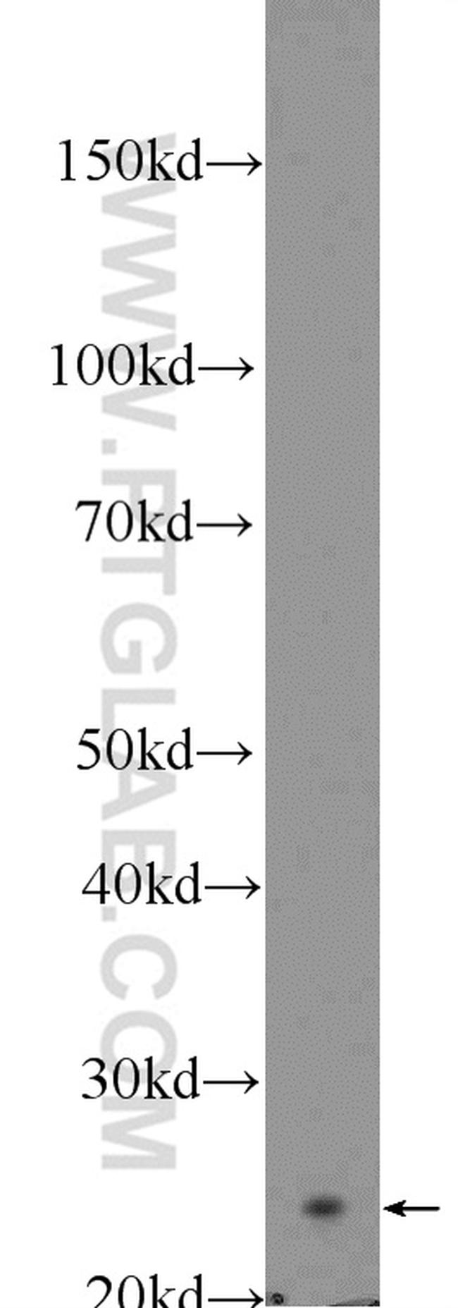 ARHGDIB Antibody in Western Blot (WB)