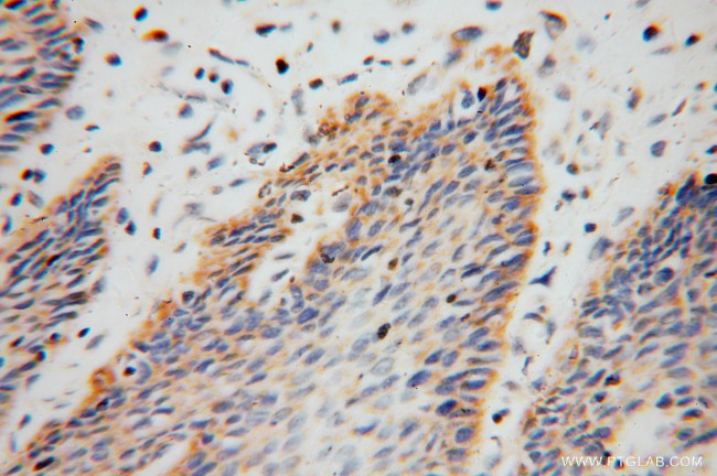 ARHGDIB Antibody in Immunohistochemistry (Paraffin) (IHC (P))