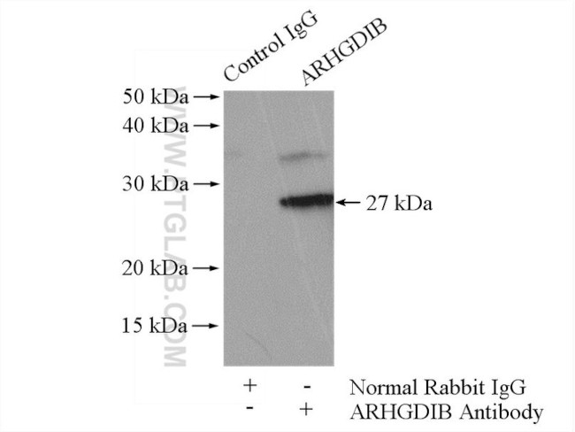 ARHGDIB Antibody in Immunoprecipitation (IP)