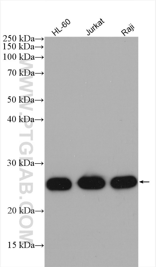 ARHGDIB Antibody in Western Blot (WB)