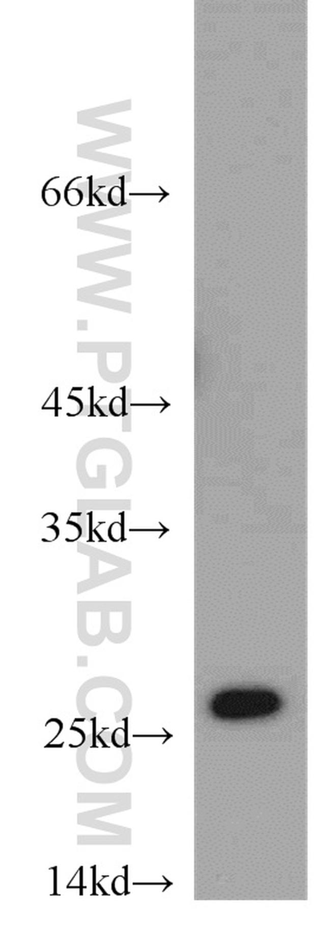 ARHGDIB Antibody in Western Blot (WB)