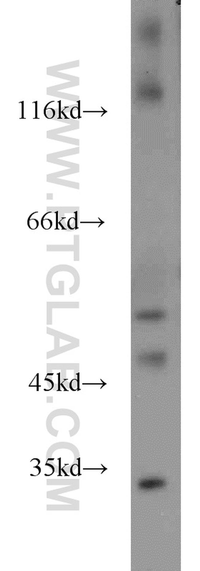 HMBOX1 Antibody in Western Blot (WB)