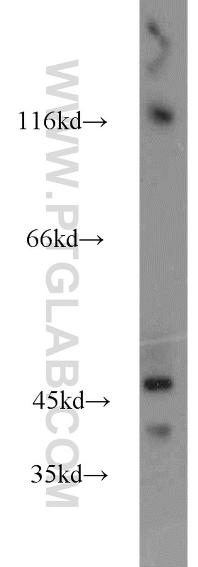 HMBOX1 Antibody in Western Blot (WB)