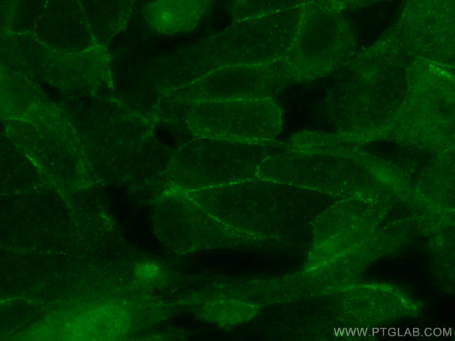 TARA Antibody in Immunocytochemistry (ICC/IF)