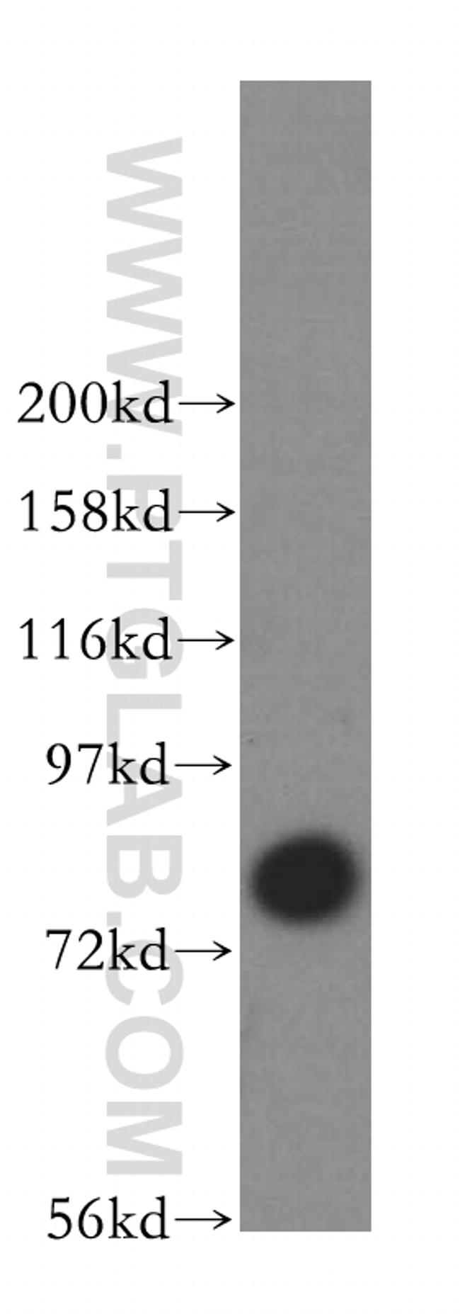 TARA Antibody in Western Blot (WB)