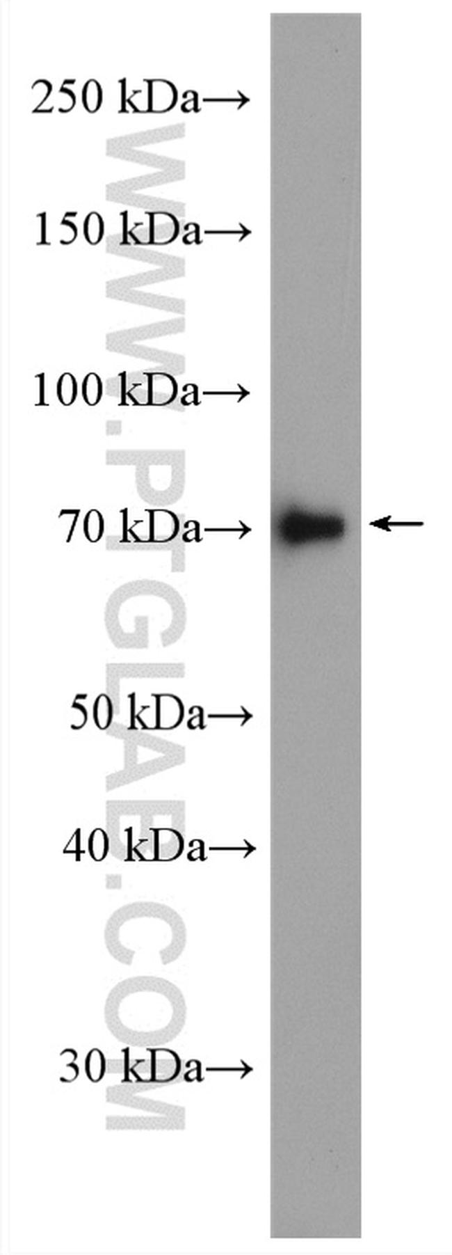 TARA Antibody in Western Blot (WB)